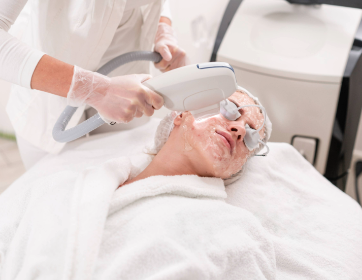 acne scars treatment procedures
