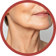 Aging Neck and Loss of Facial Harmony