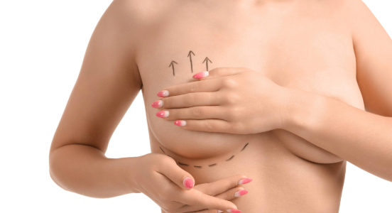 Benelli Breast Lift