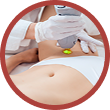 bikini laser hair removal