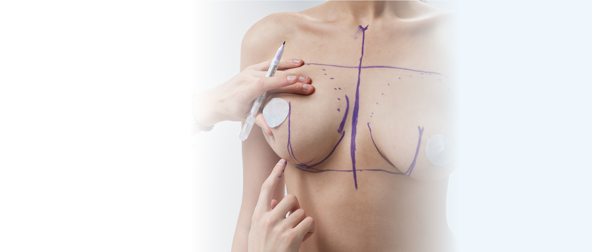breast lift benelli