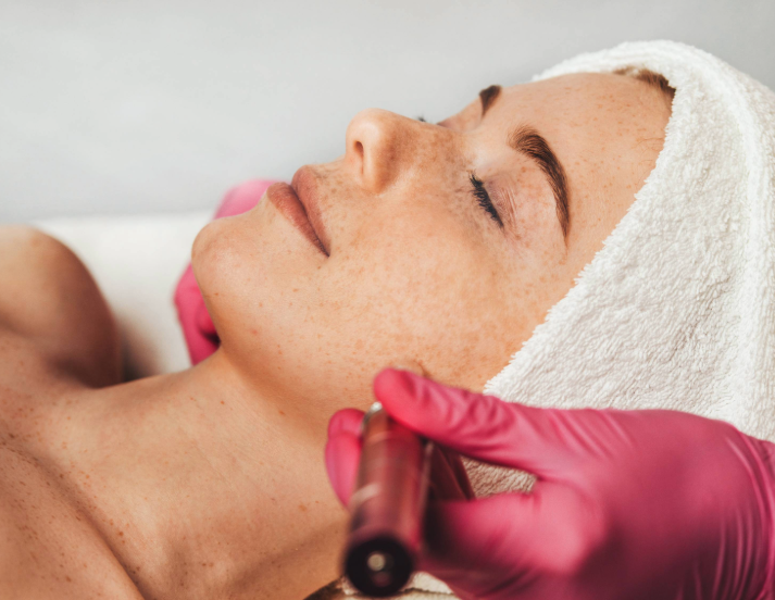 cost of skin laser treatments in New Jersey
