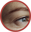 crows feet