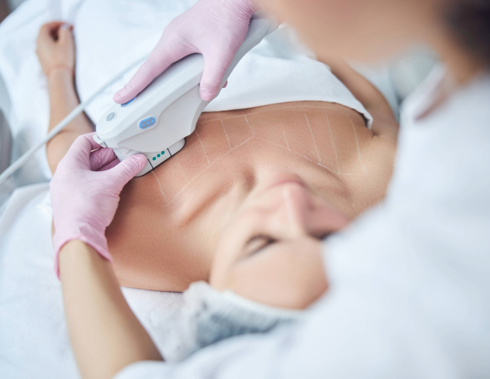decollete treatment procedures