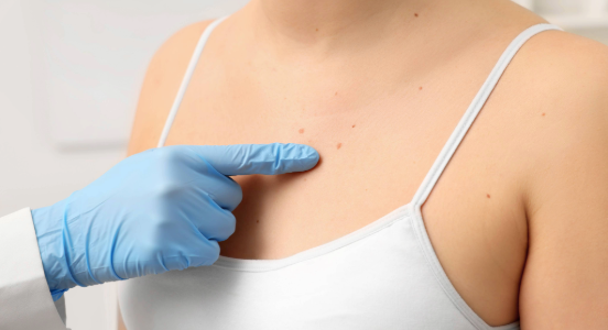 Décolleté Treatment