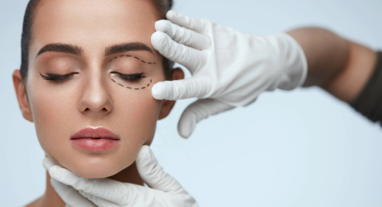 Eyelid Surgery (Blepharoplasty)