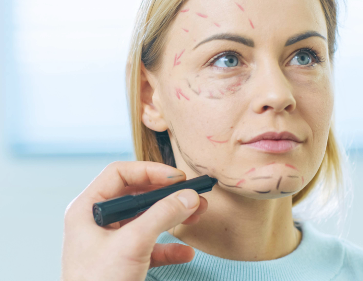 face skin tightening