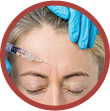 forehead lines and frown lines
