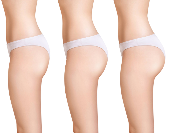 how butt augmentation works