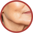 jawline slimming and tmj symptoms