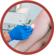 Laser Treatment for Spider Veins