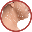 Sagging Skin and Excess Fat Under the Chin