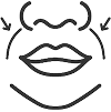 Smile Lines & Nasolabial Folds