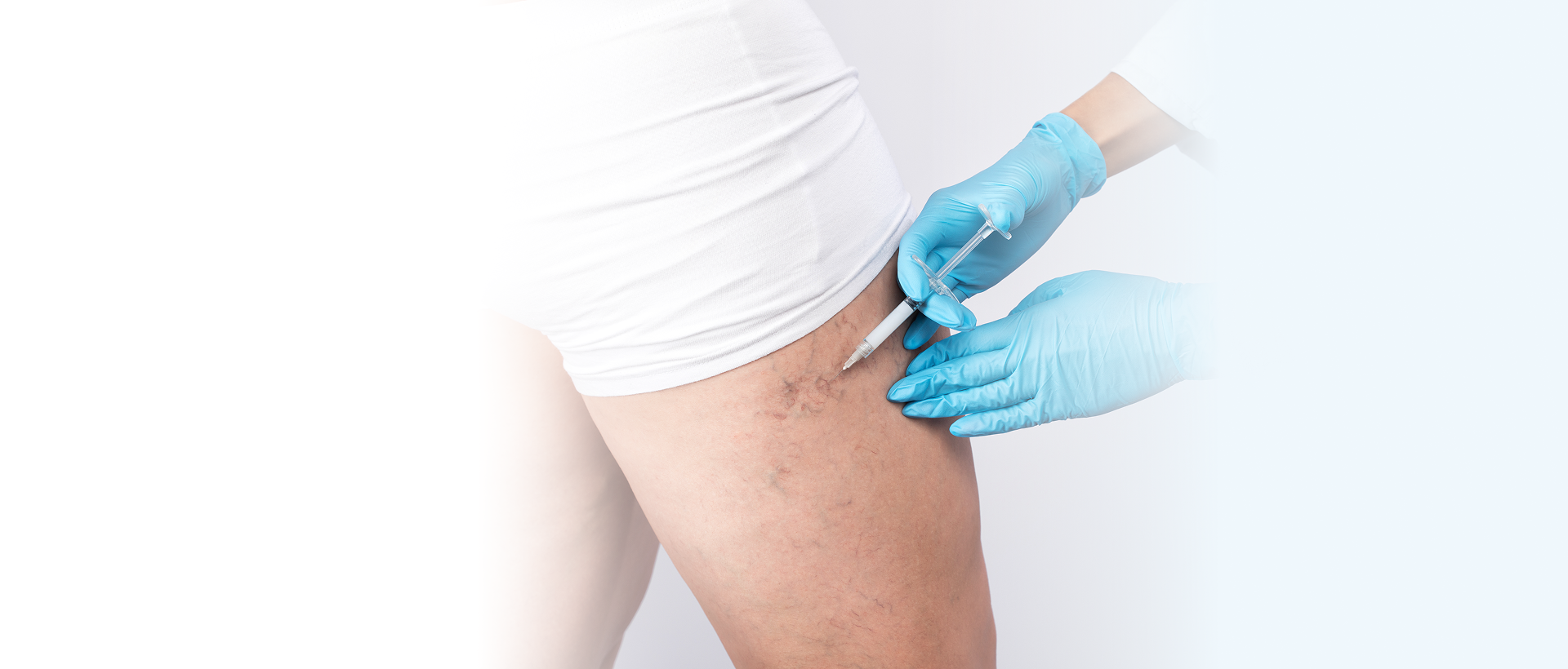 spider vein treatment in New Jersey