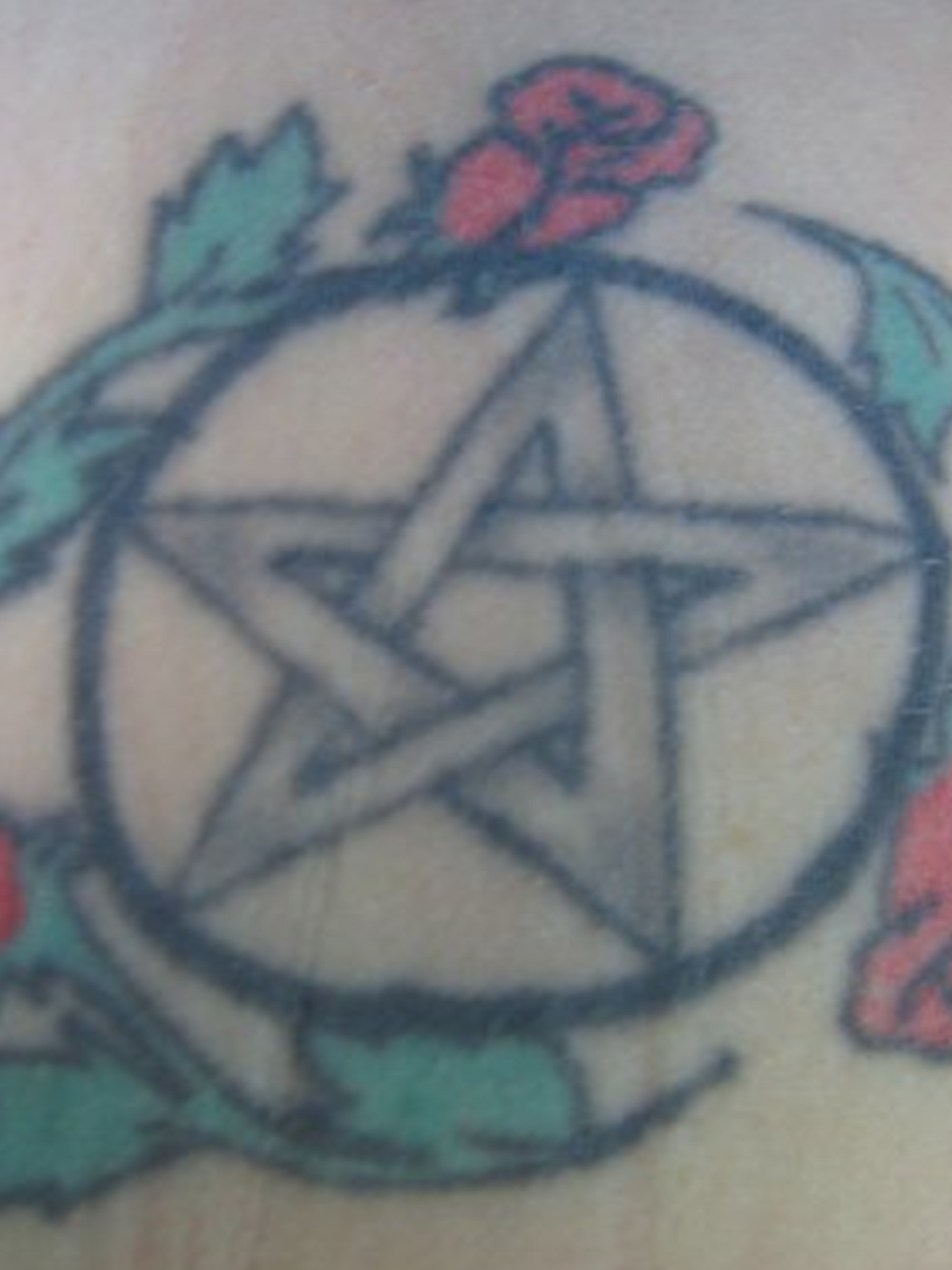 tattoo removal before 3