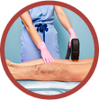Telangiectasia Treatment