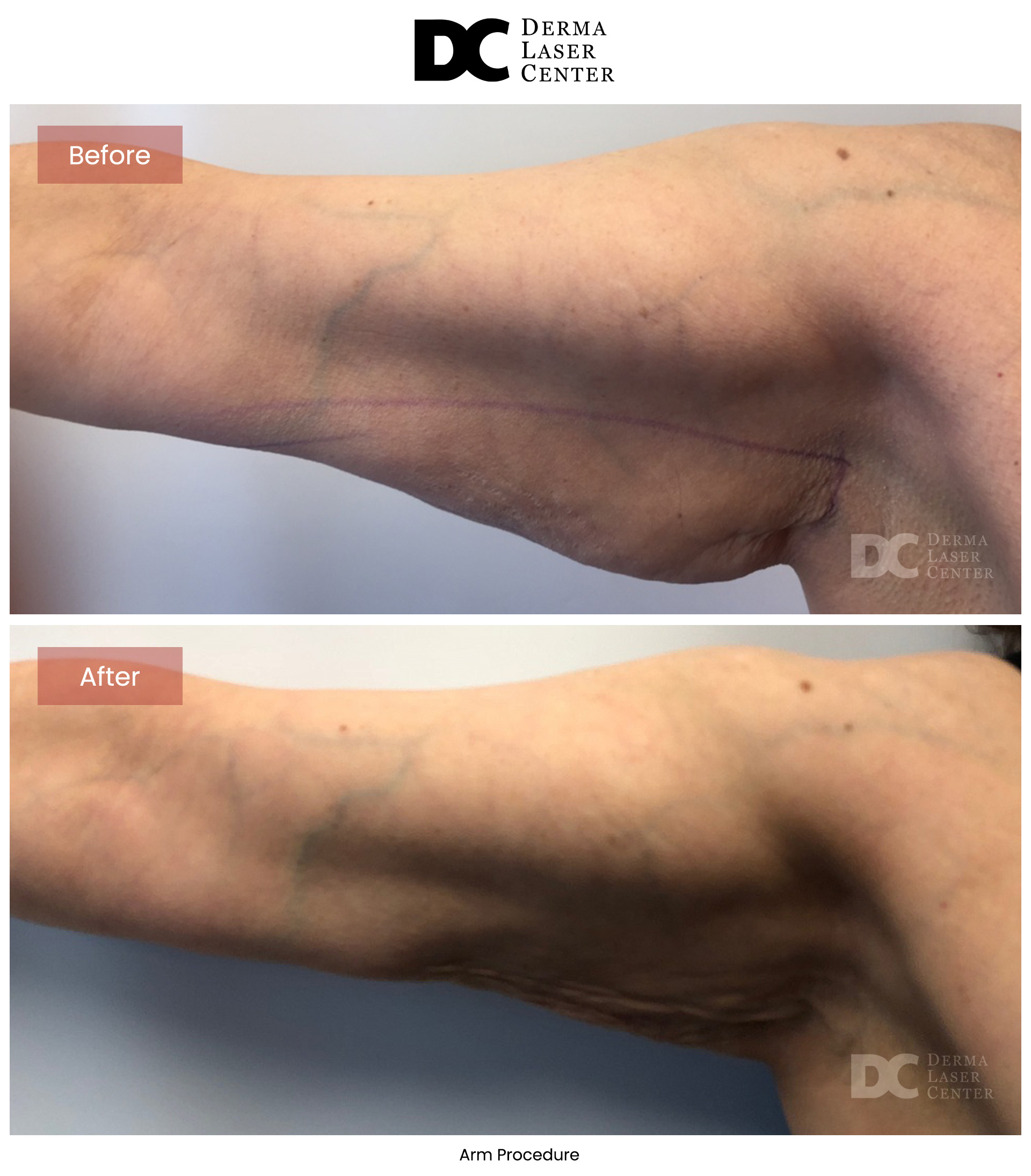 B&A Arms Image 01 V1