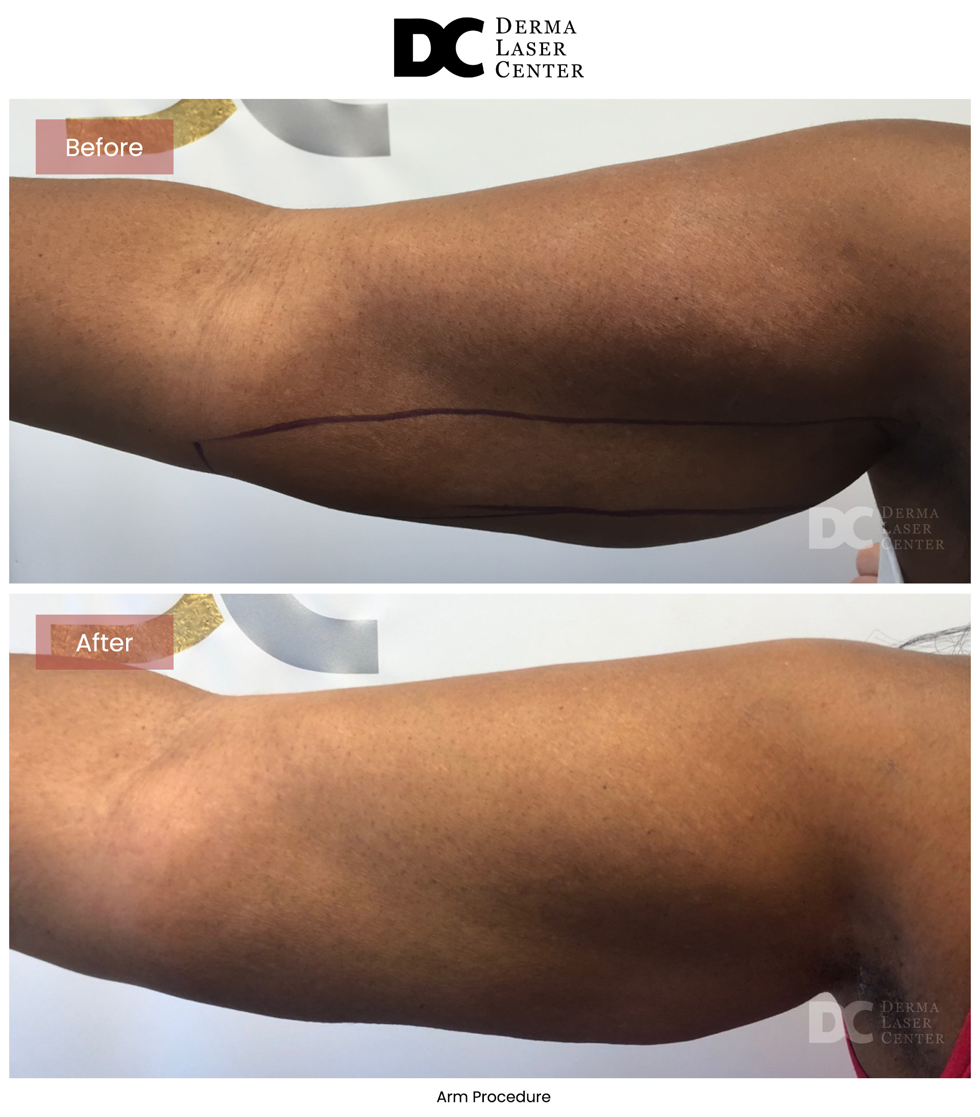 B&A Arms Image 02 V1