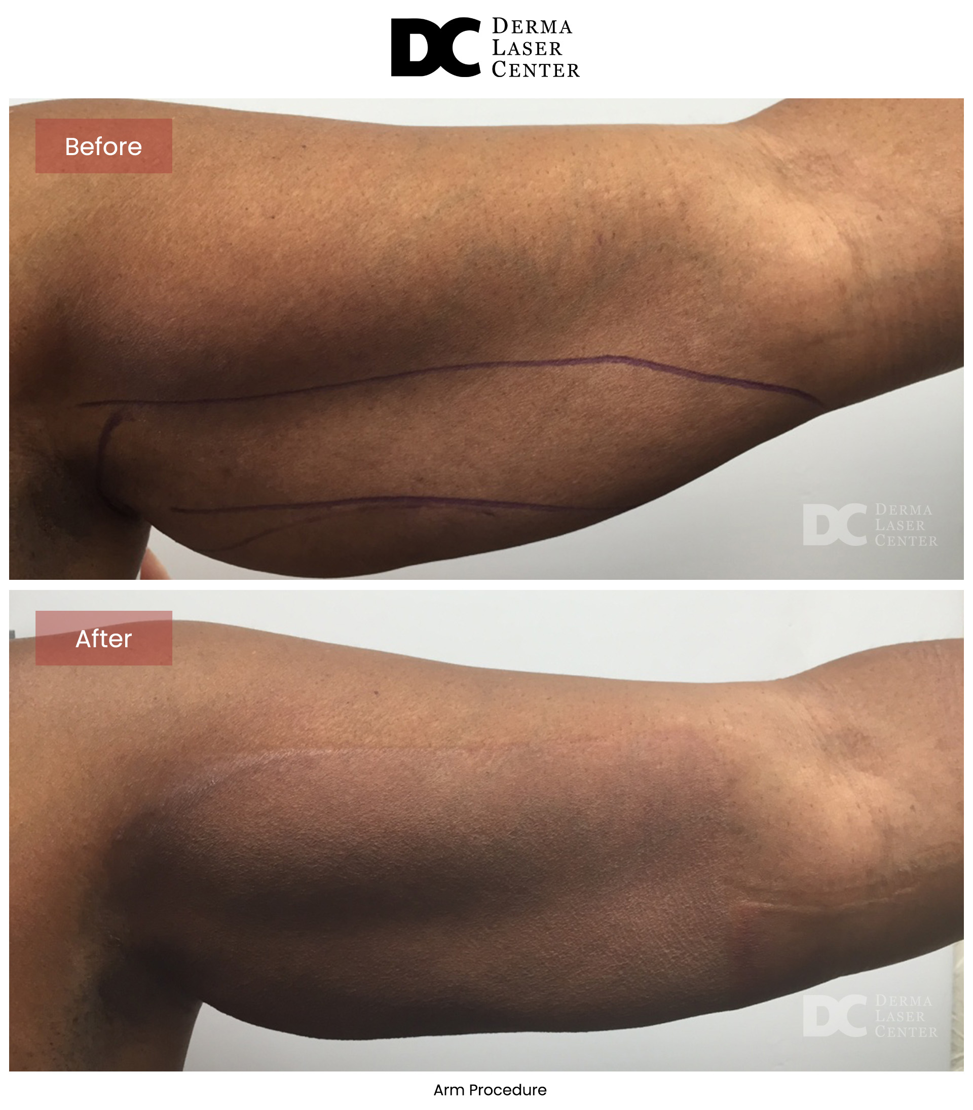 B&A Arms Image 03 V1