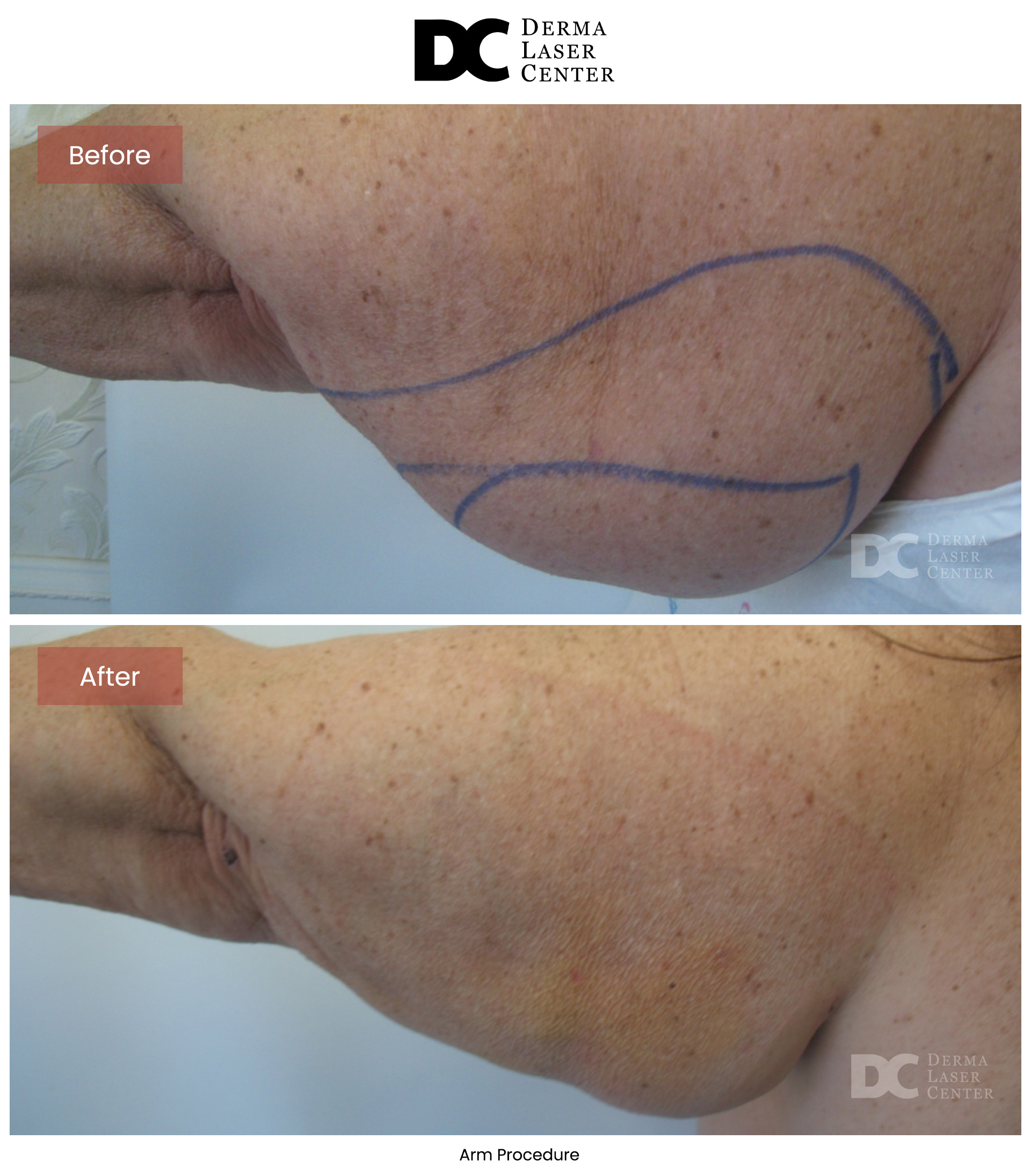 B&A Arms Image 04 V1