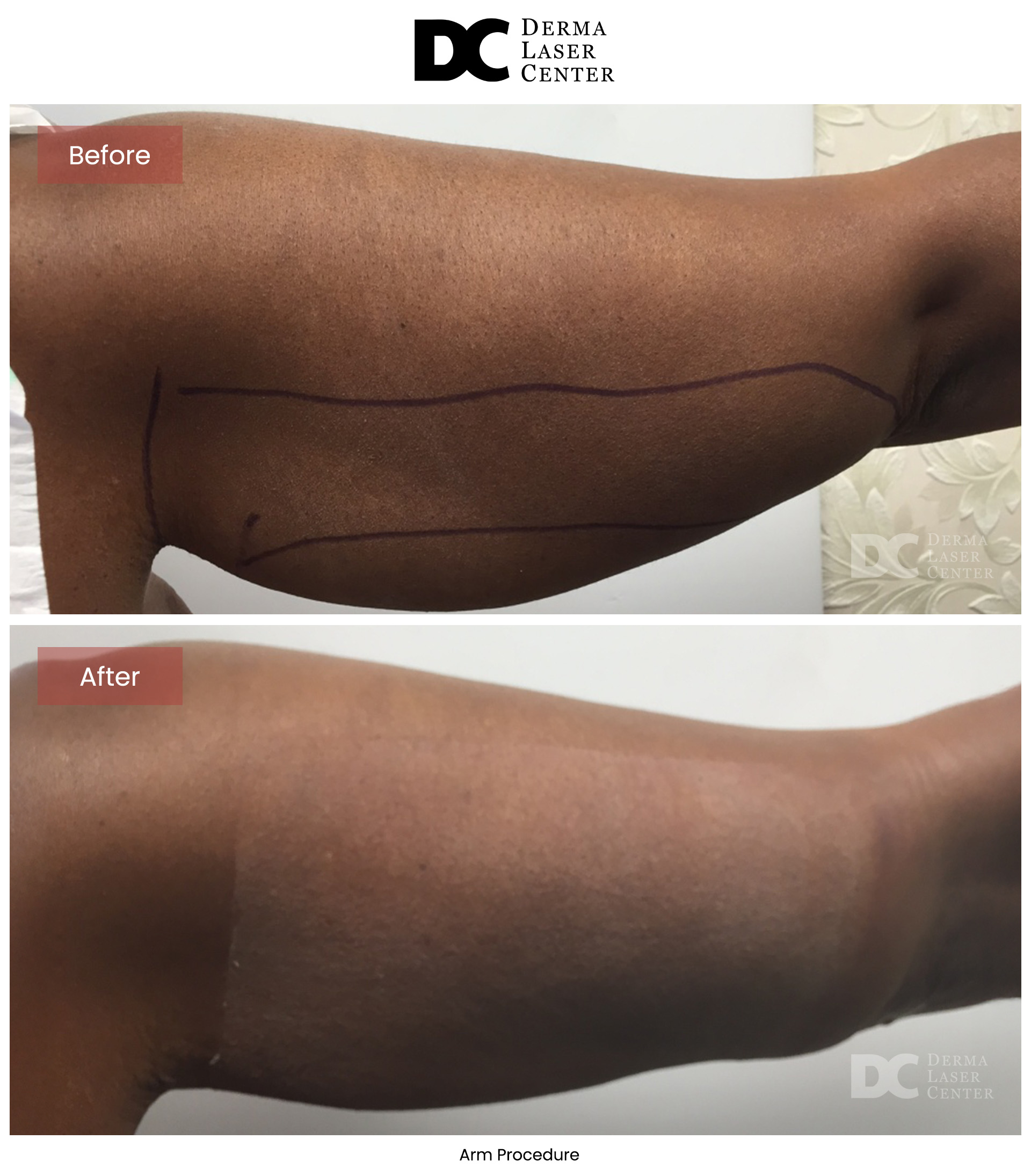 B&A Arms Image 05 V1