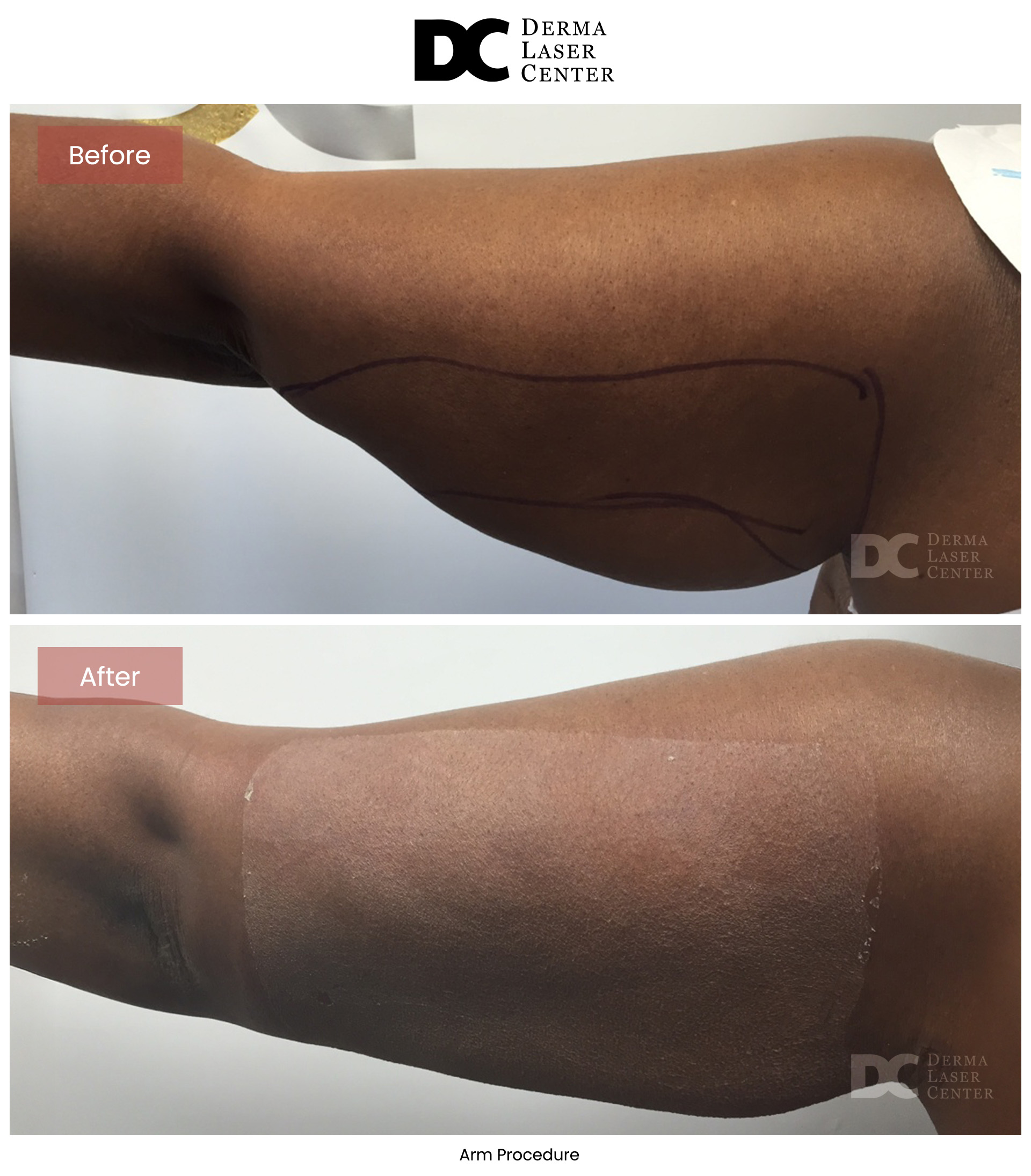 B&A Arms Image 06 V1