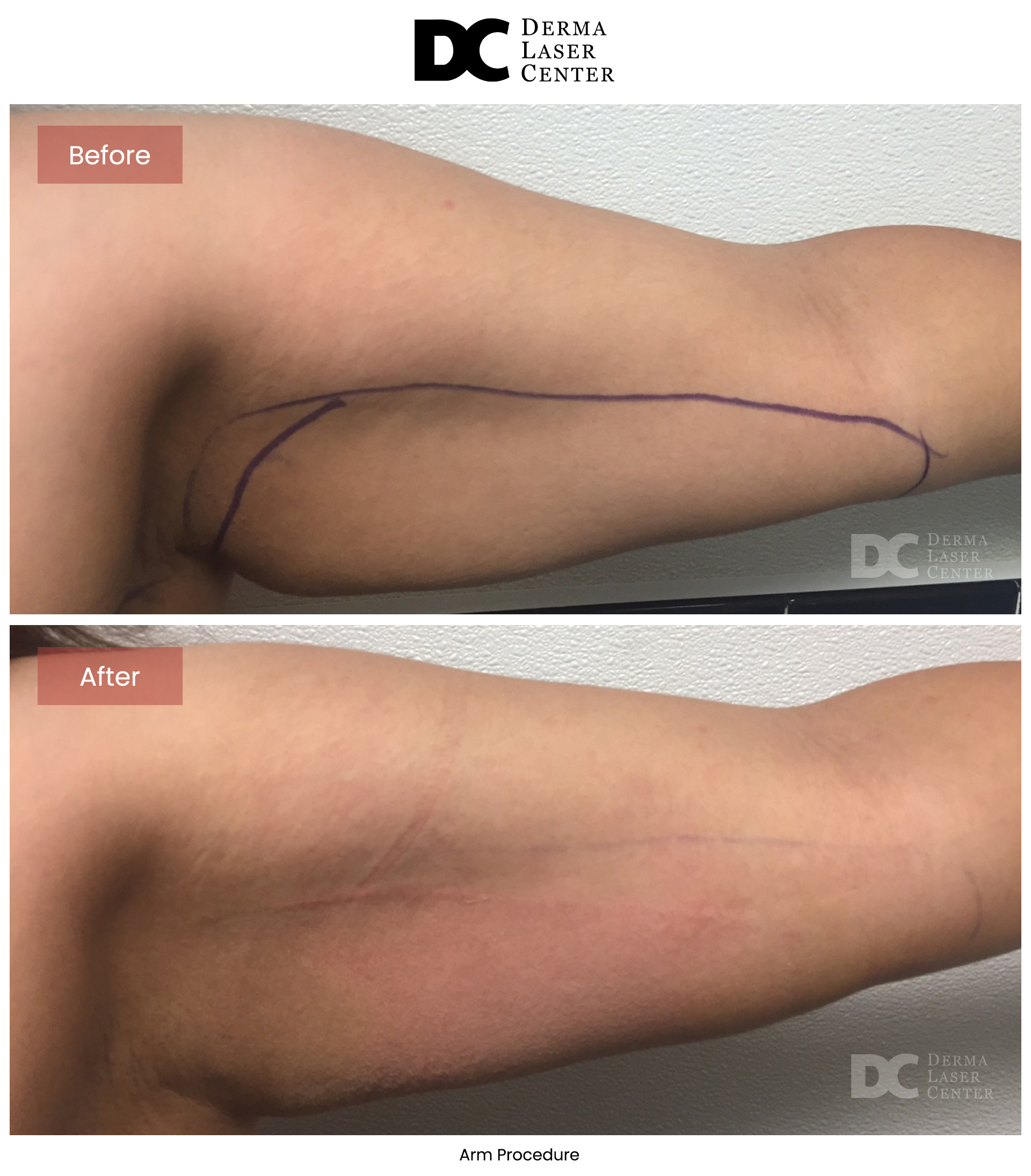 B&A Arms Image 07 V1