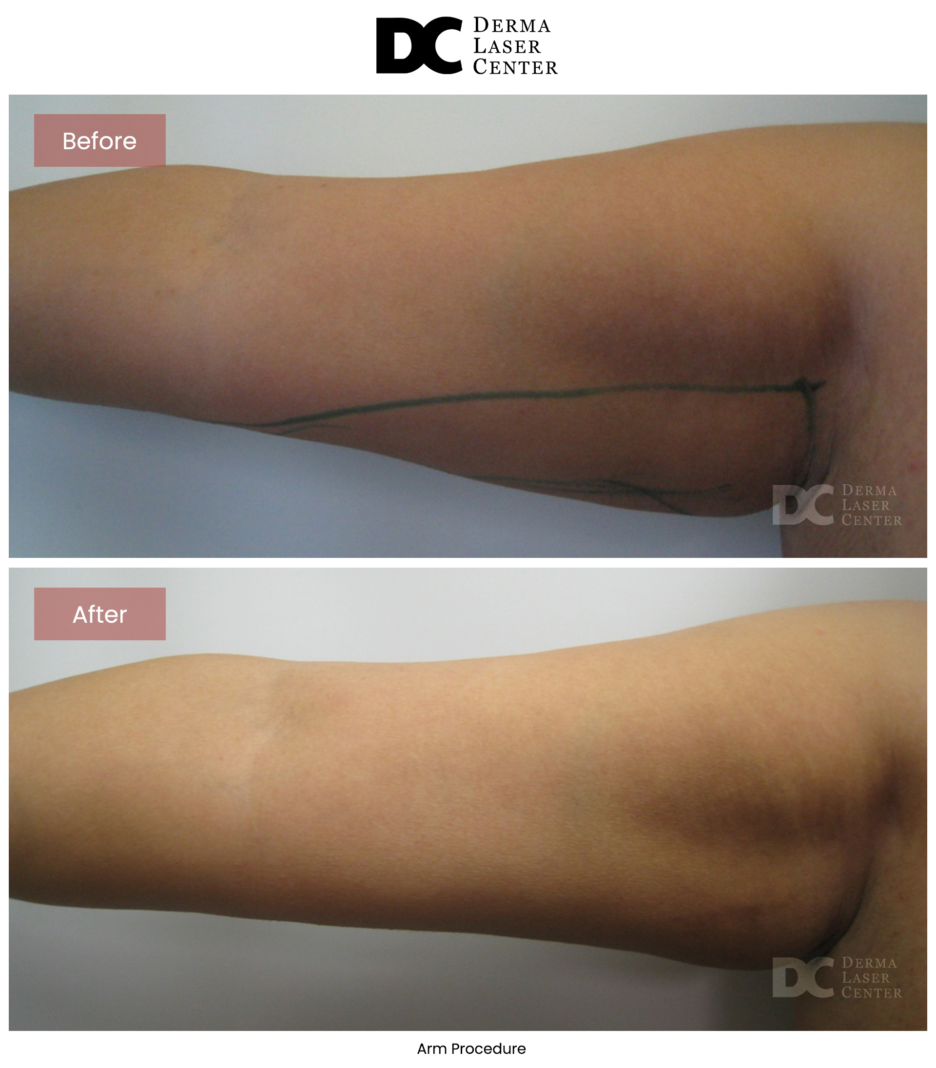 B&A Arms Image 08 V1