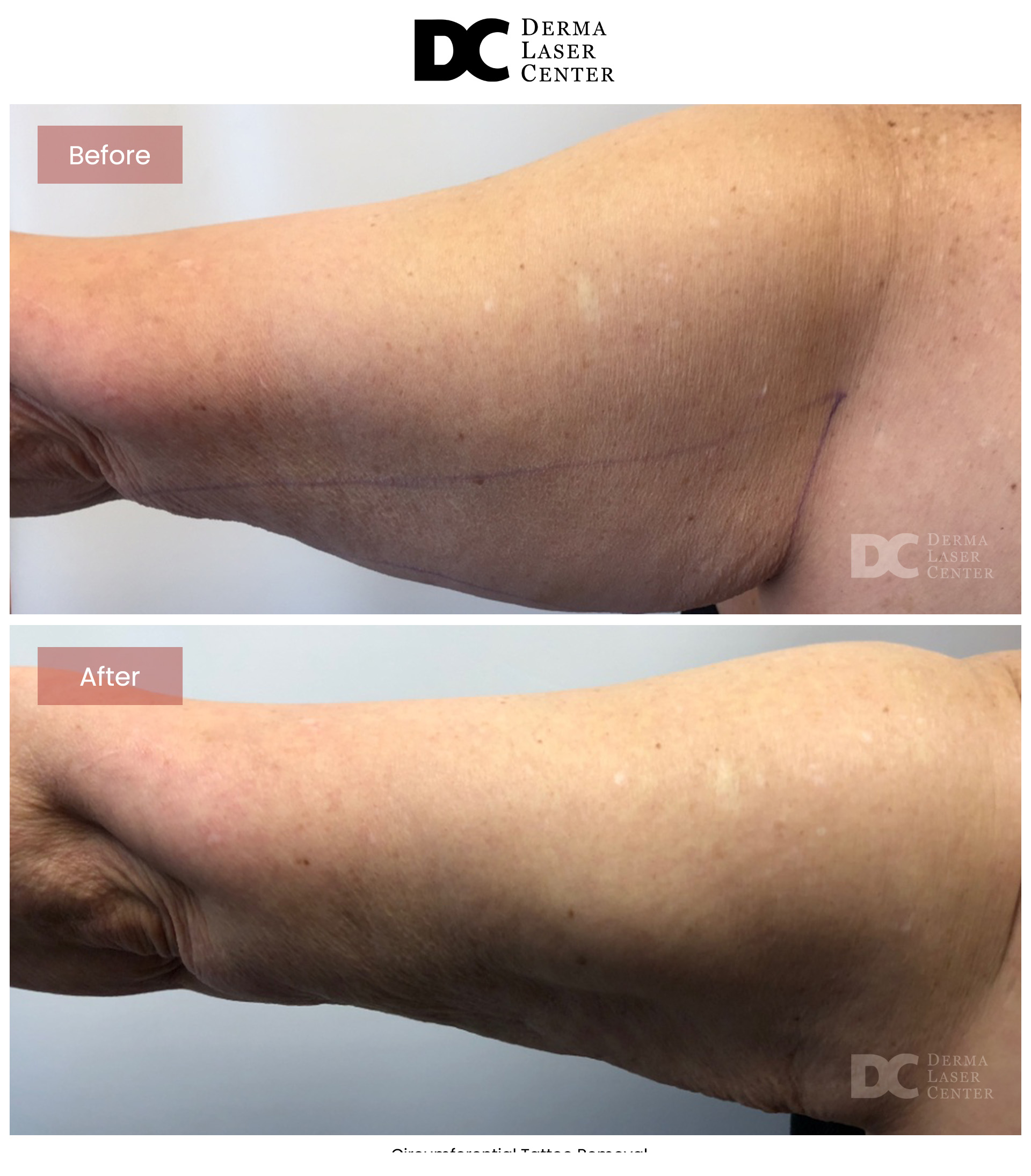 B&A Arms Image 10 V1
