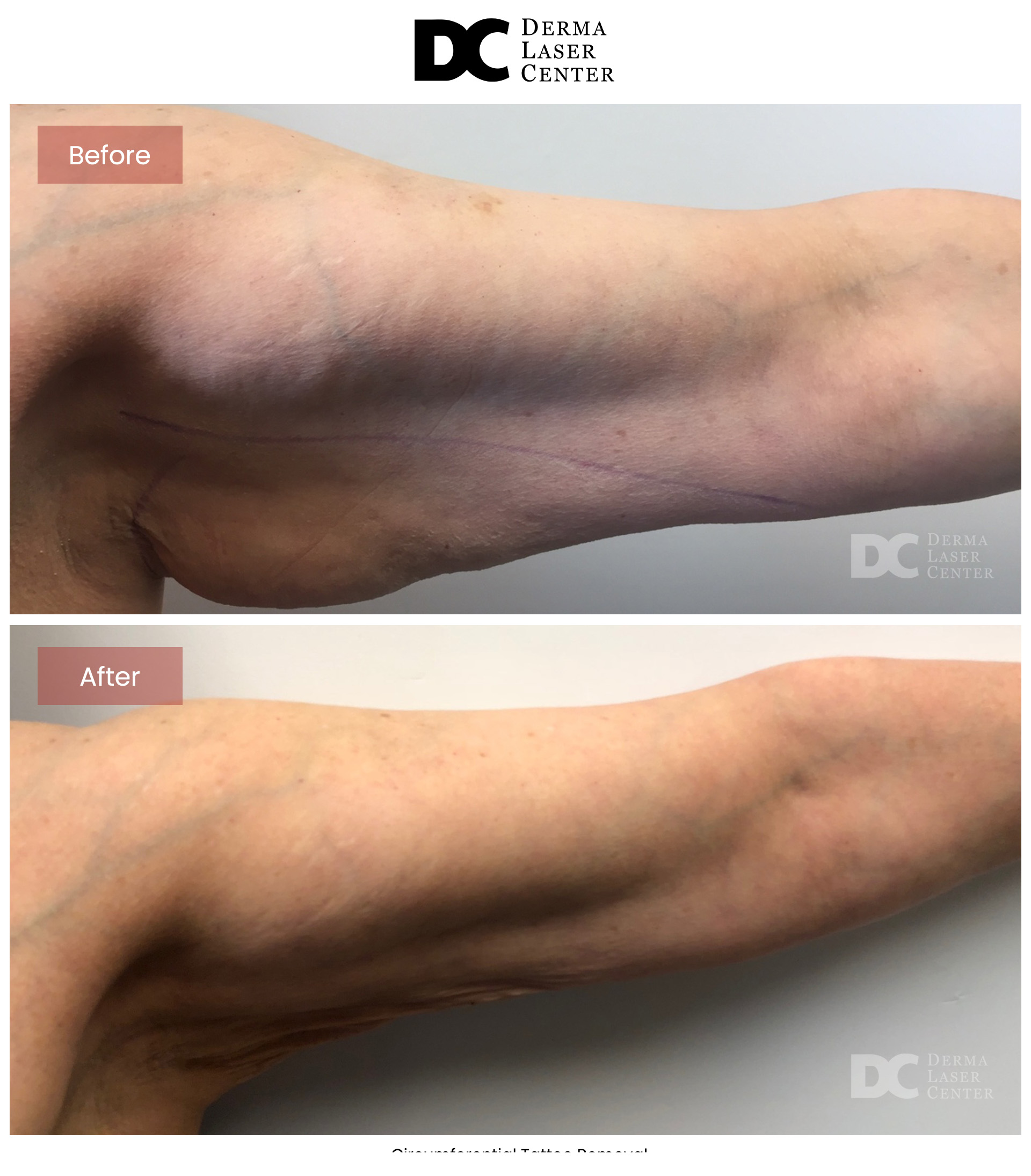 B&A Arms Image 11 V1