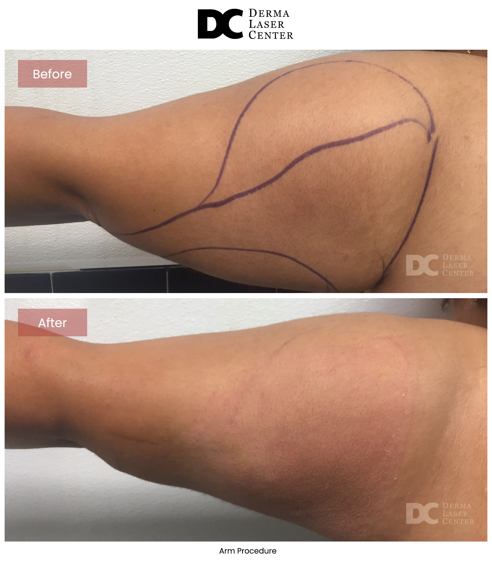 B&A Arms Image 13 V1