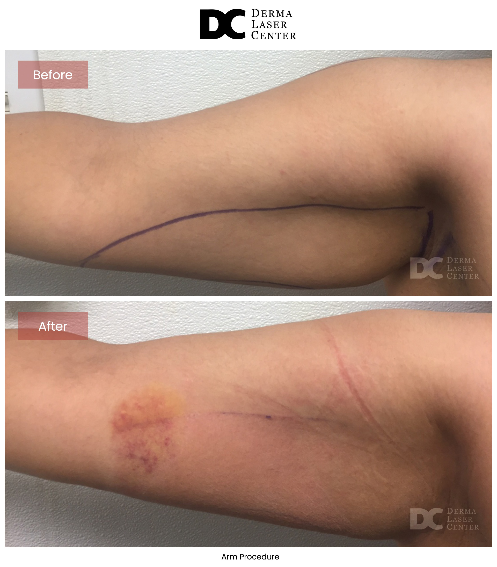 B&A Arms Image 14 V1
