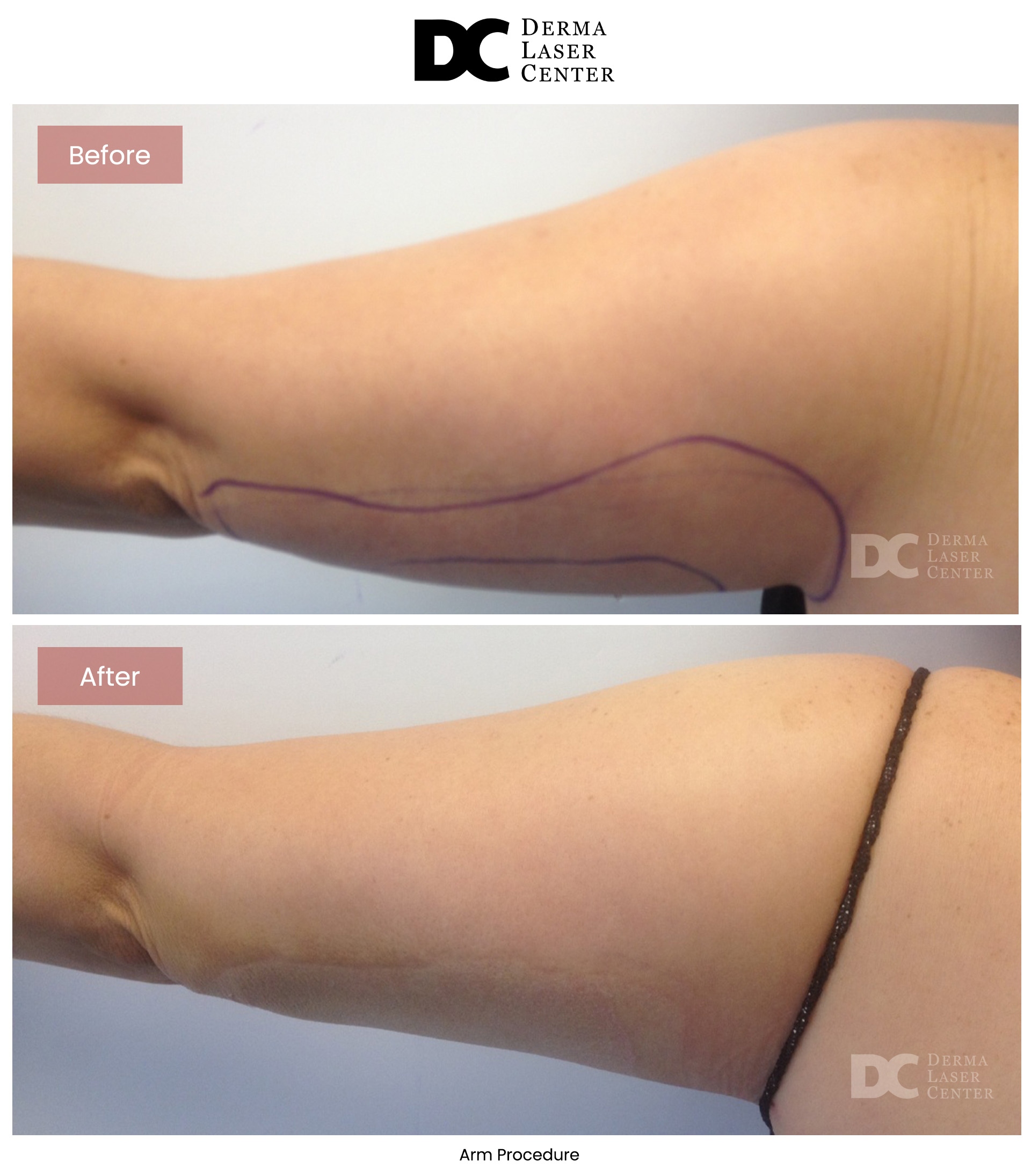 B&A Arms Image 15 V1