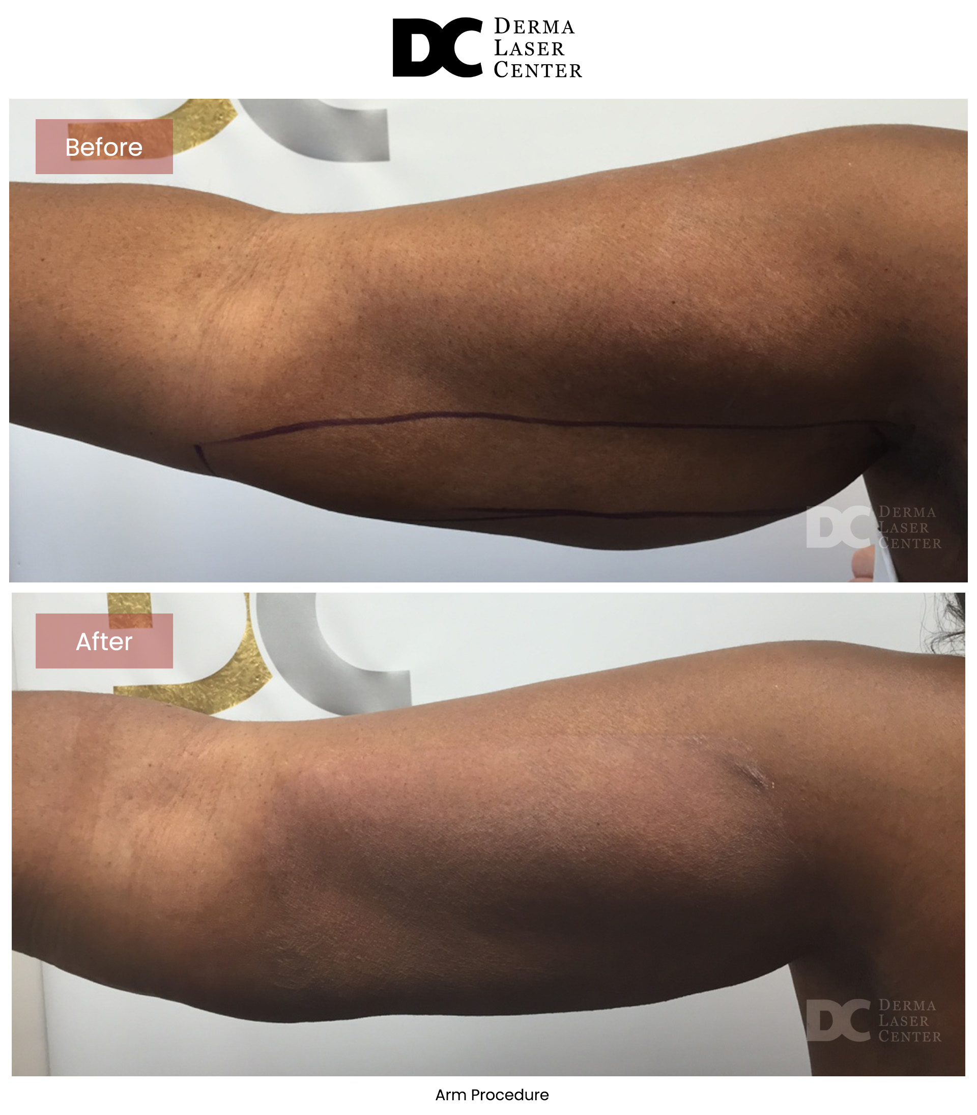 B&A Arms Image 16 V1