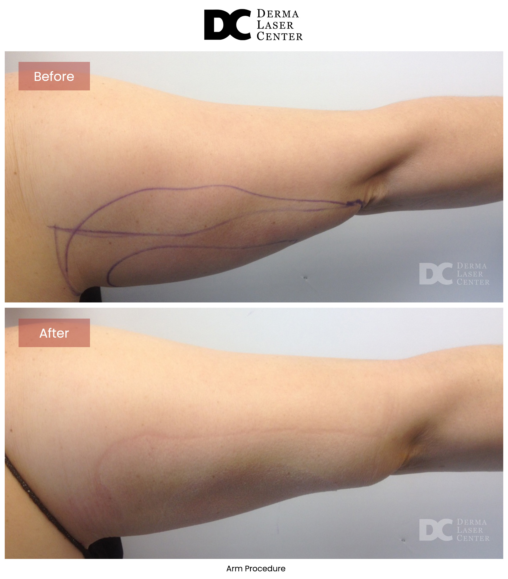B&A Arms Image 17 V1