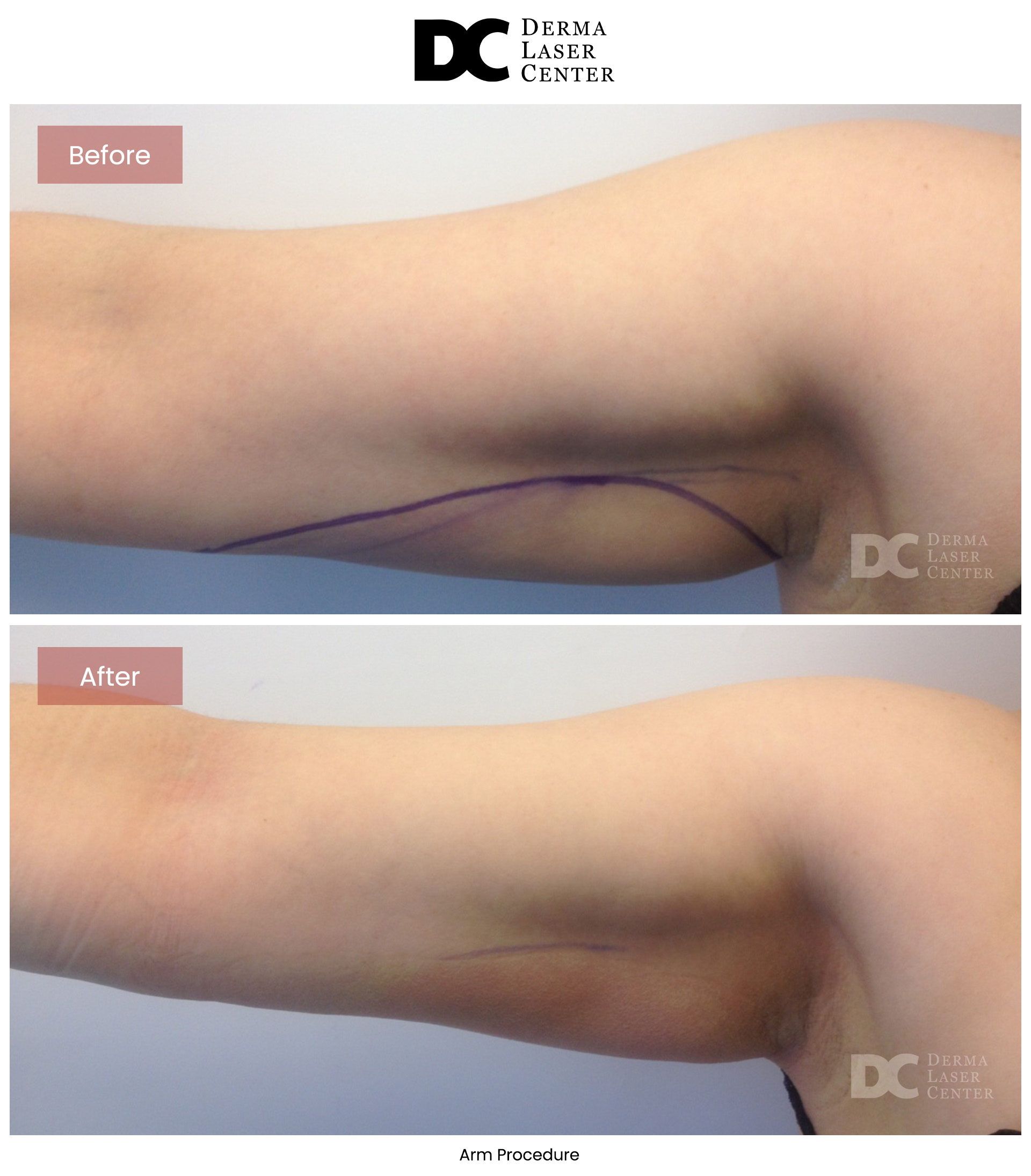 B&A Arms Image 18 V1