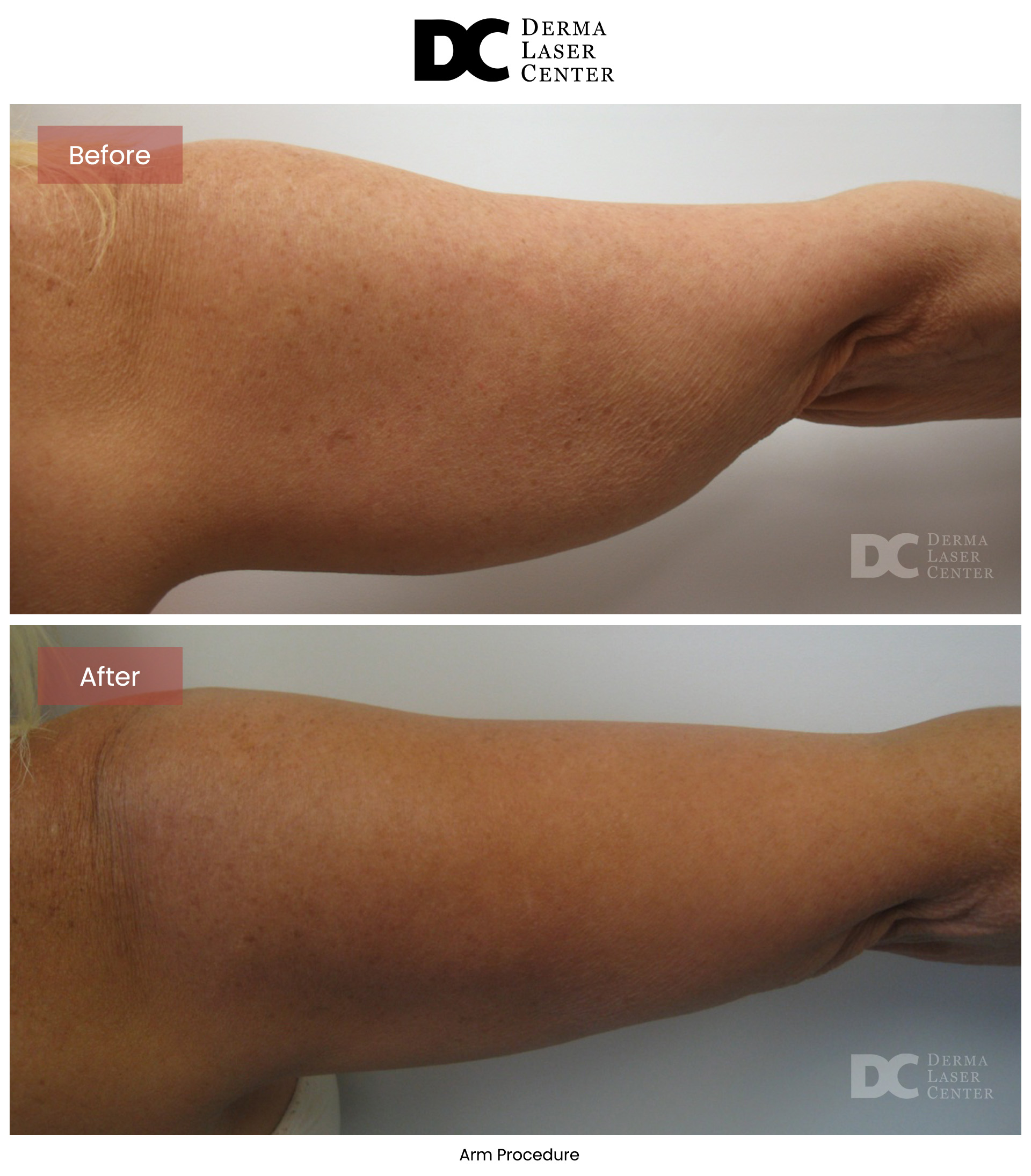 B&A Arms Image 22 V1