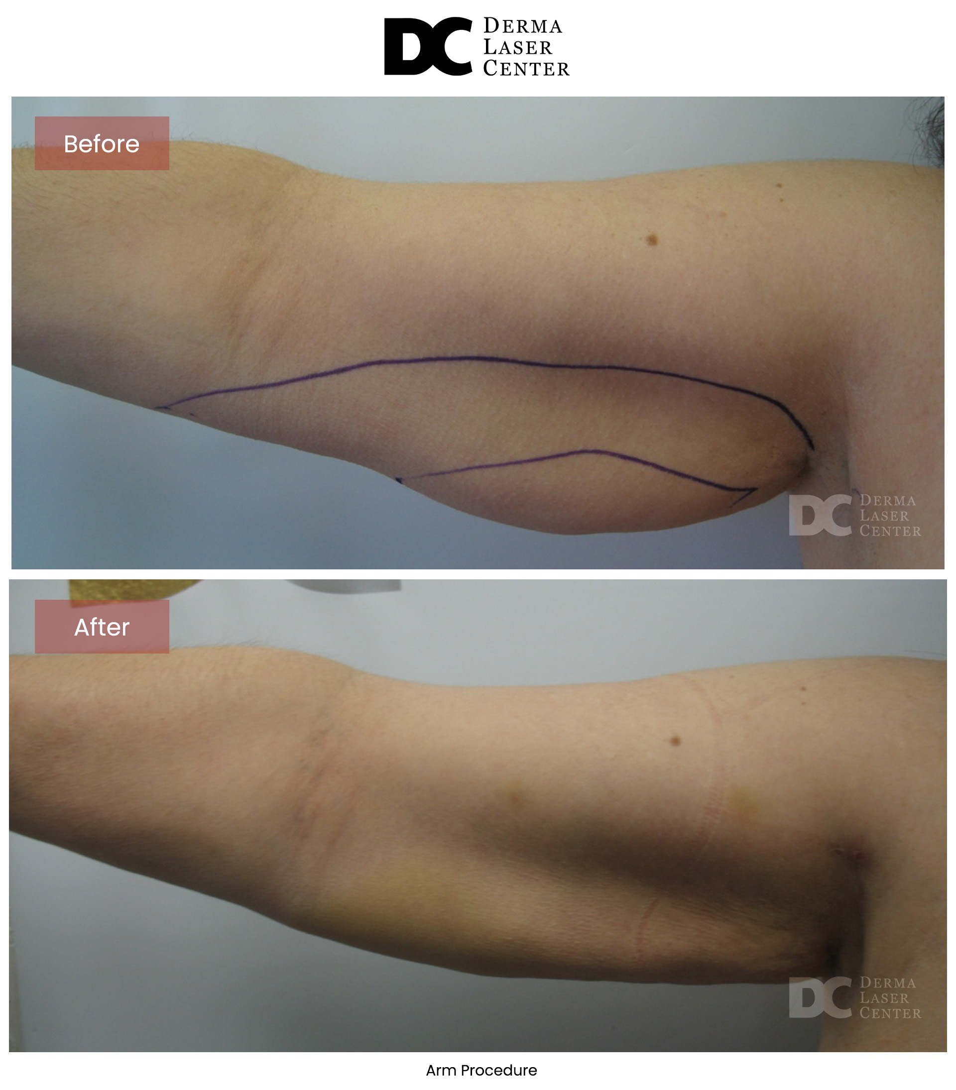 B&A Arms Image 26 V1