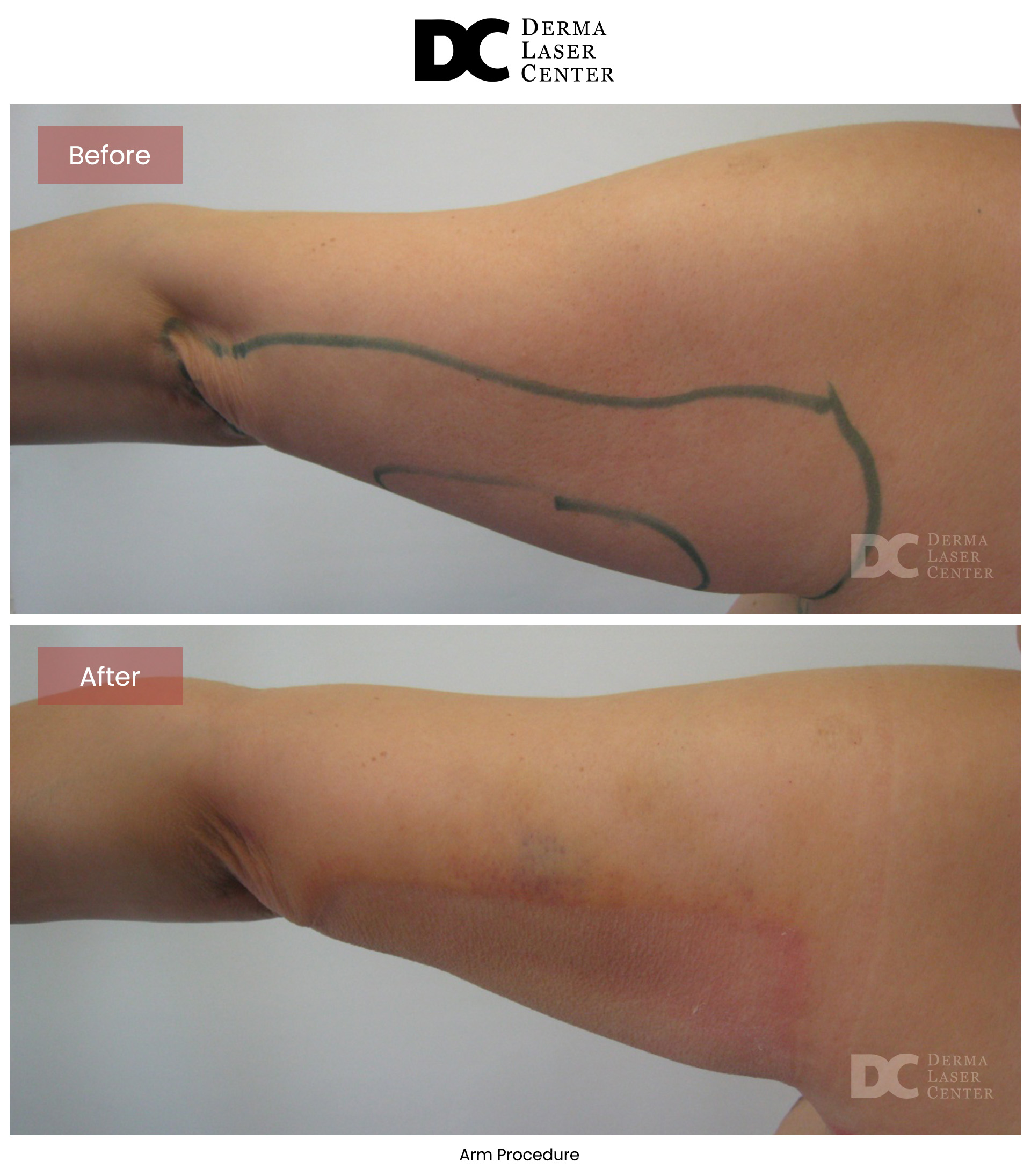 B&A Arms Image 33 V1