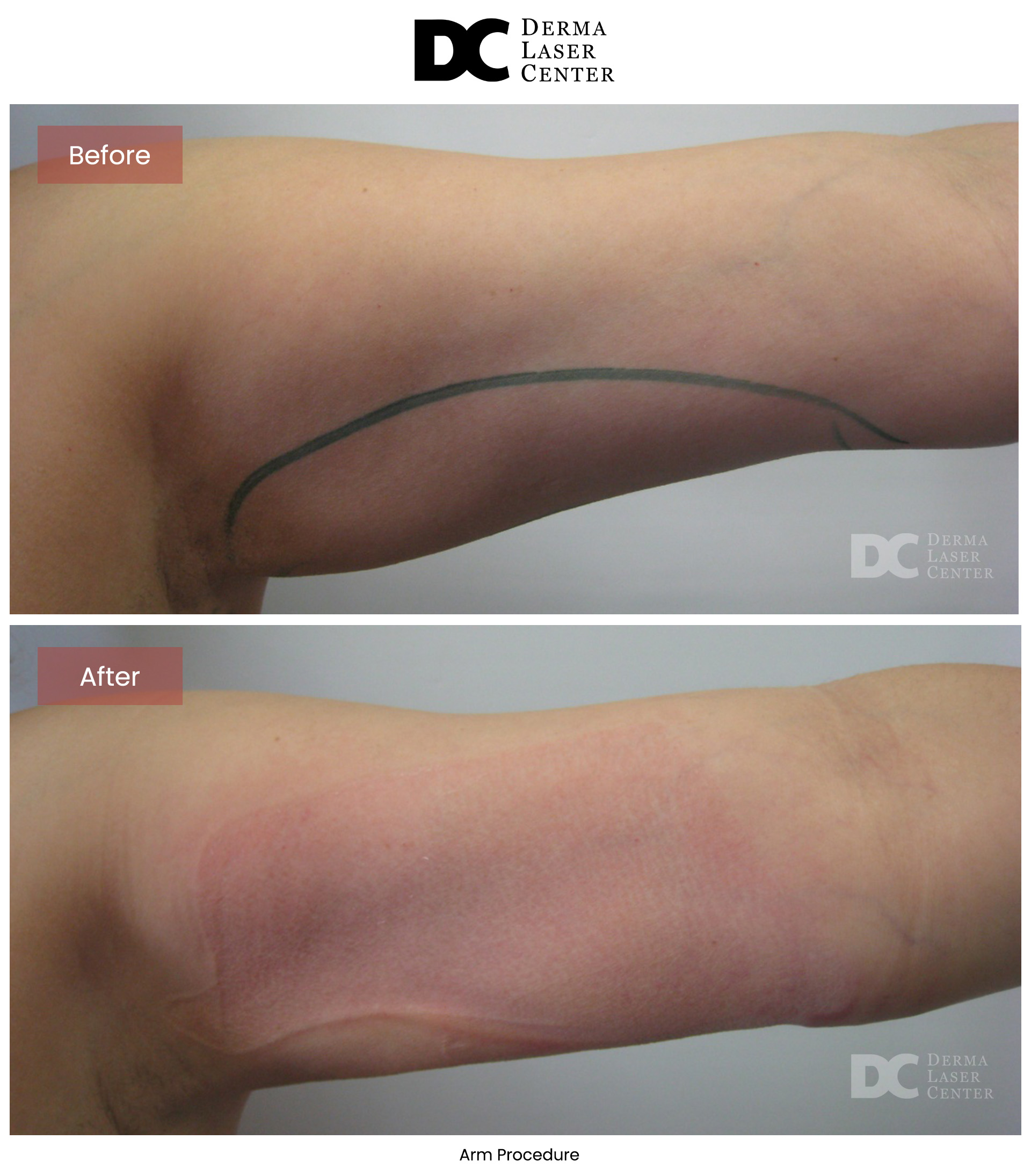 B&A Arms Image 35 V1