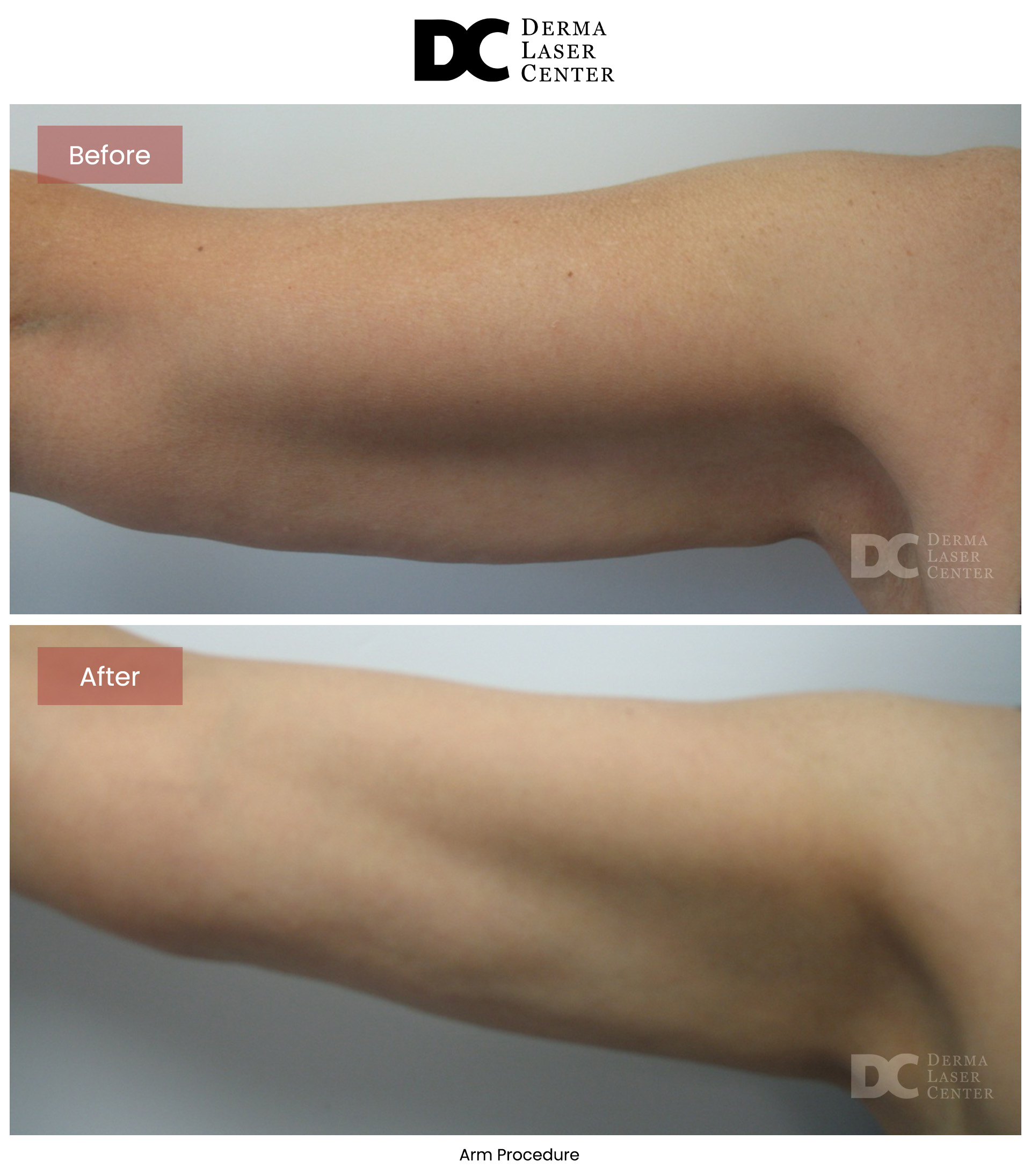 B&A Arms Image 37 V1