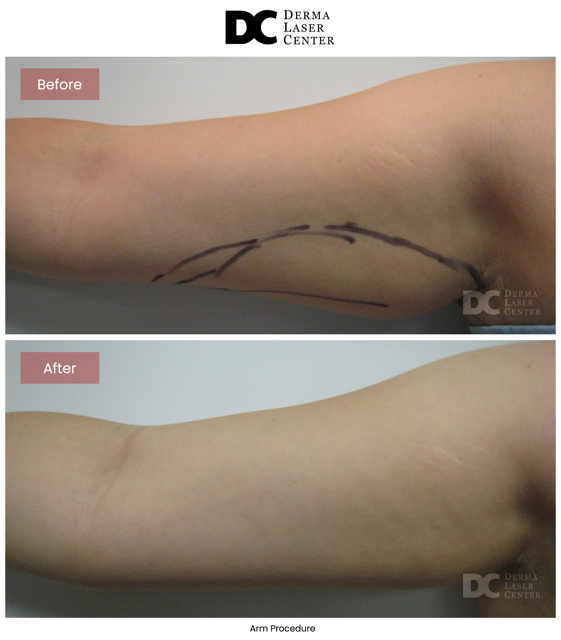B&A Arms Image 38 V1