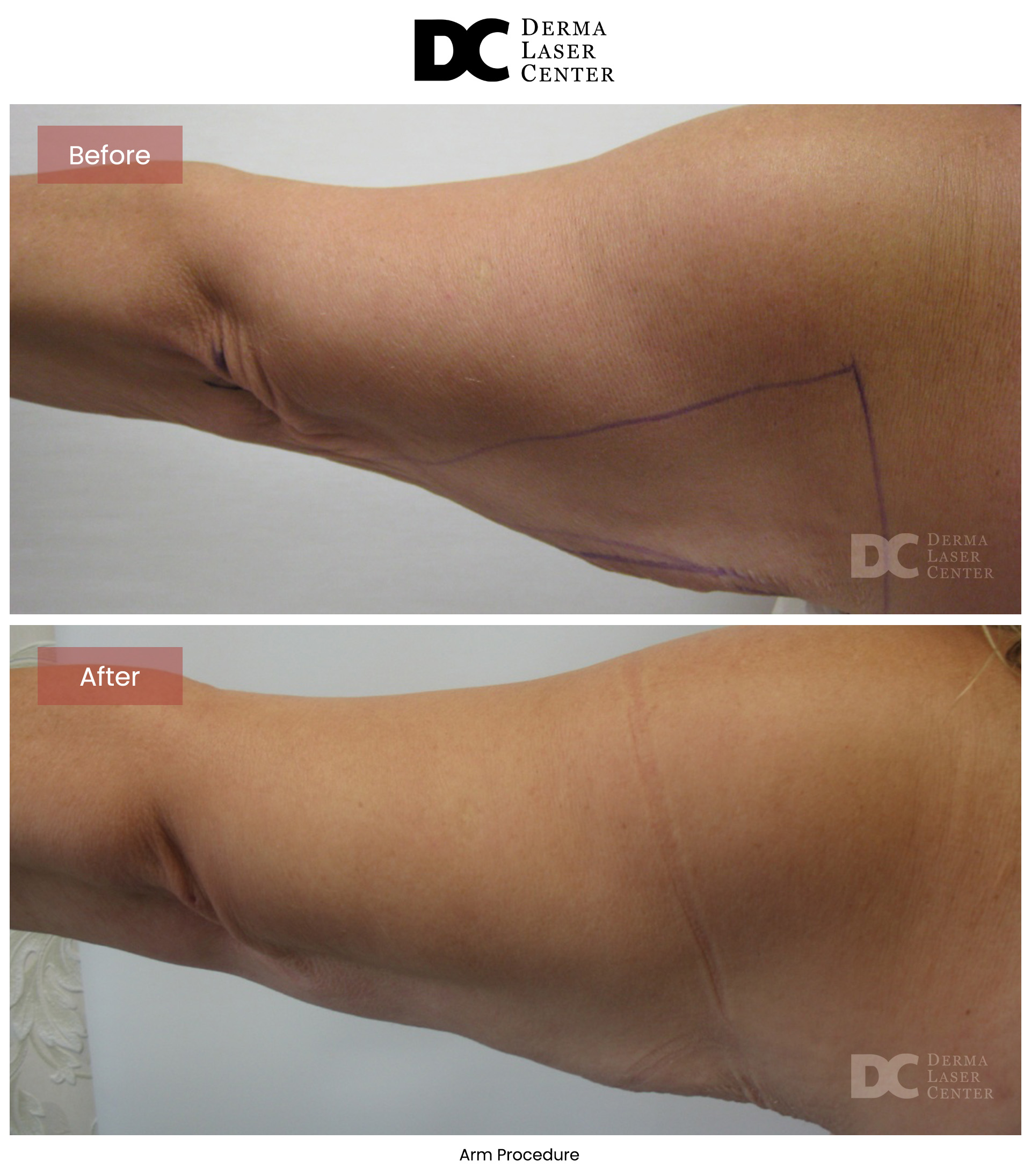 B&A Arms Image 40 V1