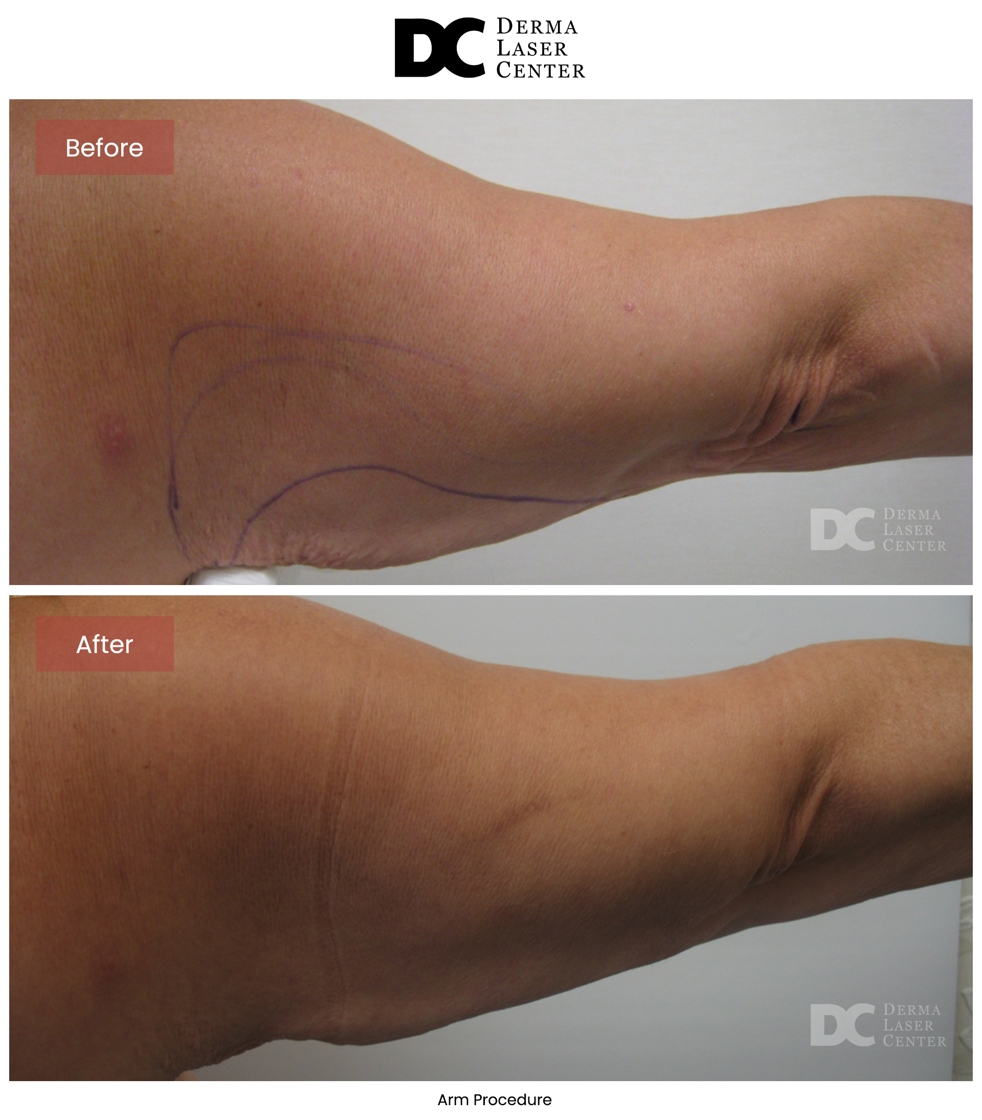 B&A Arms Image 41 V1