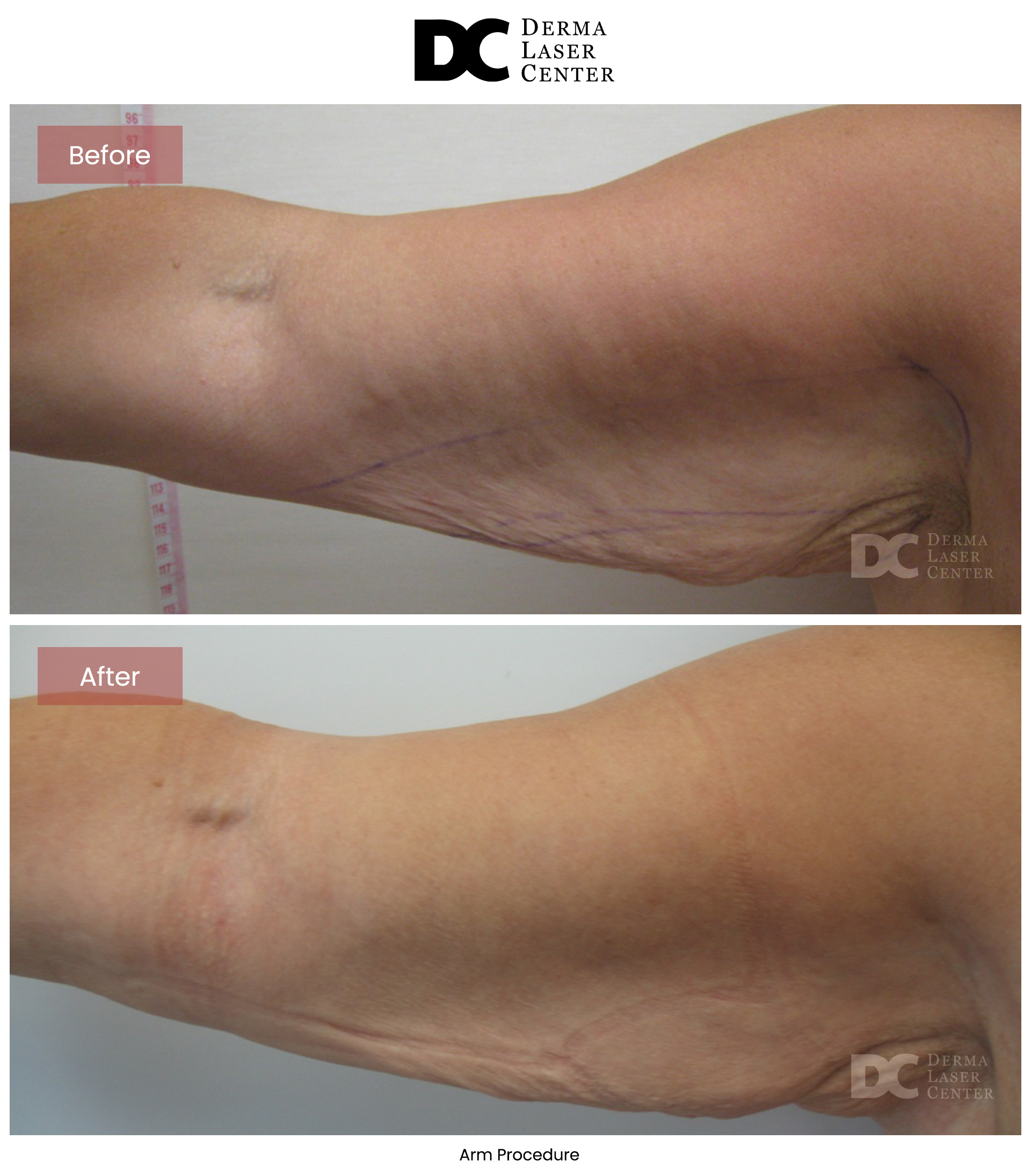 B&A Arms Image 42 V1