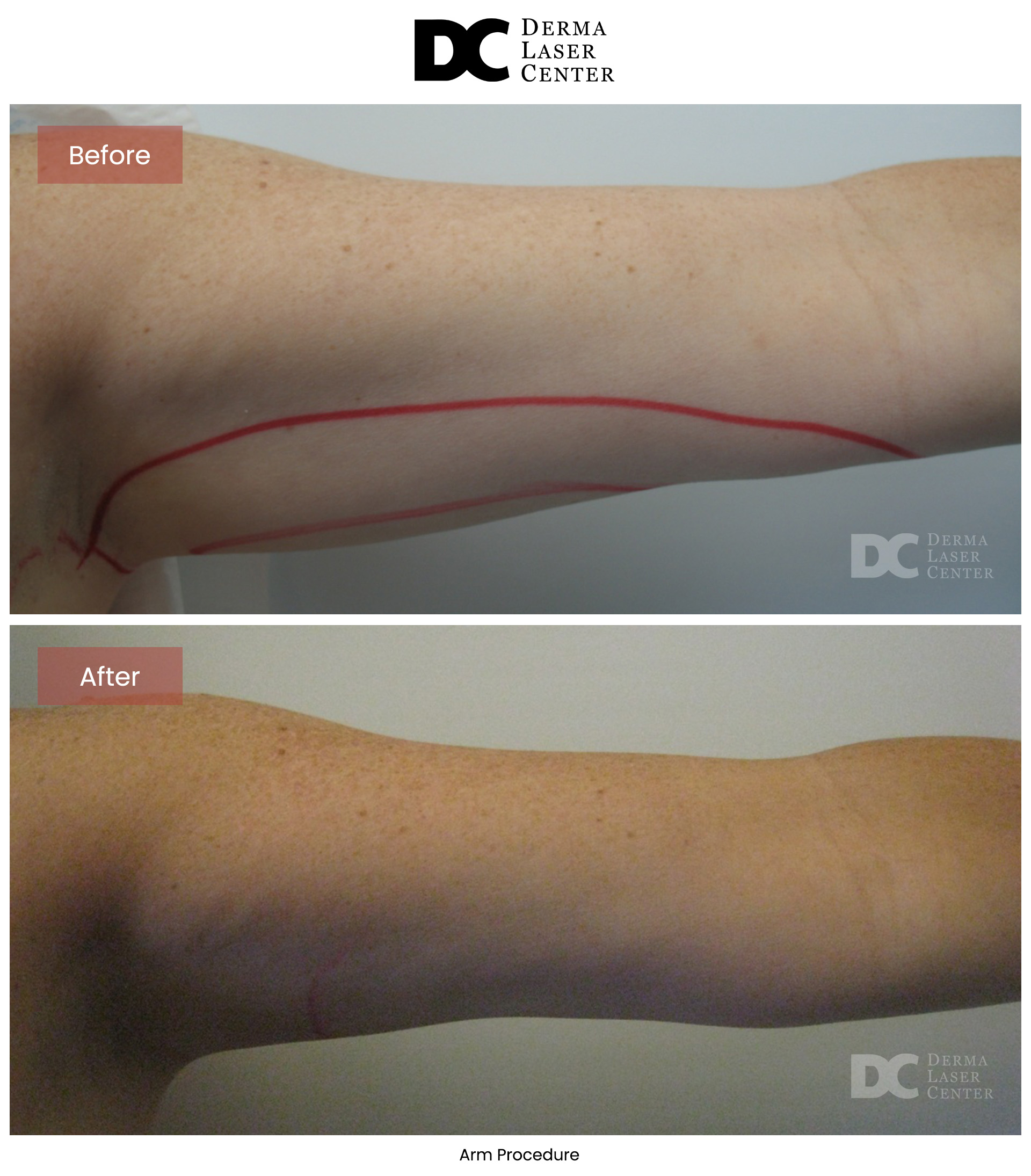 B&A Arms Image 44 V1