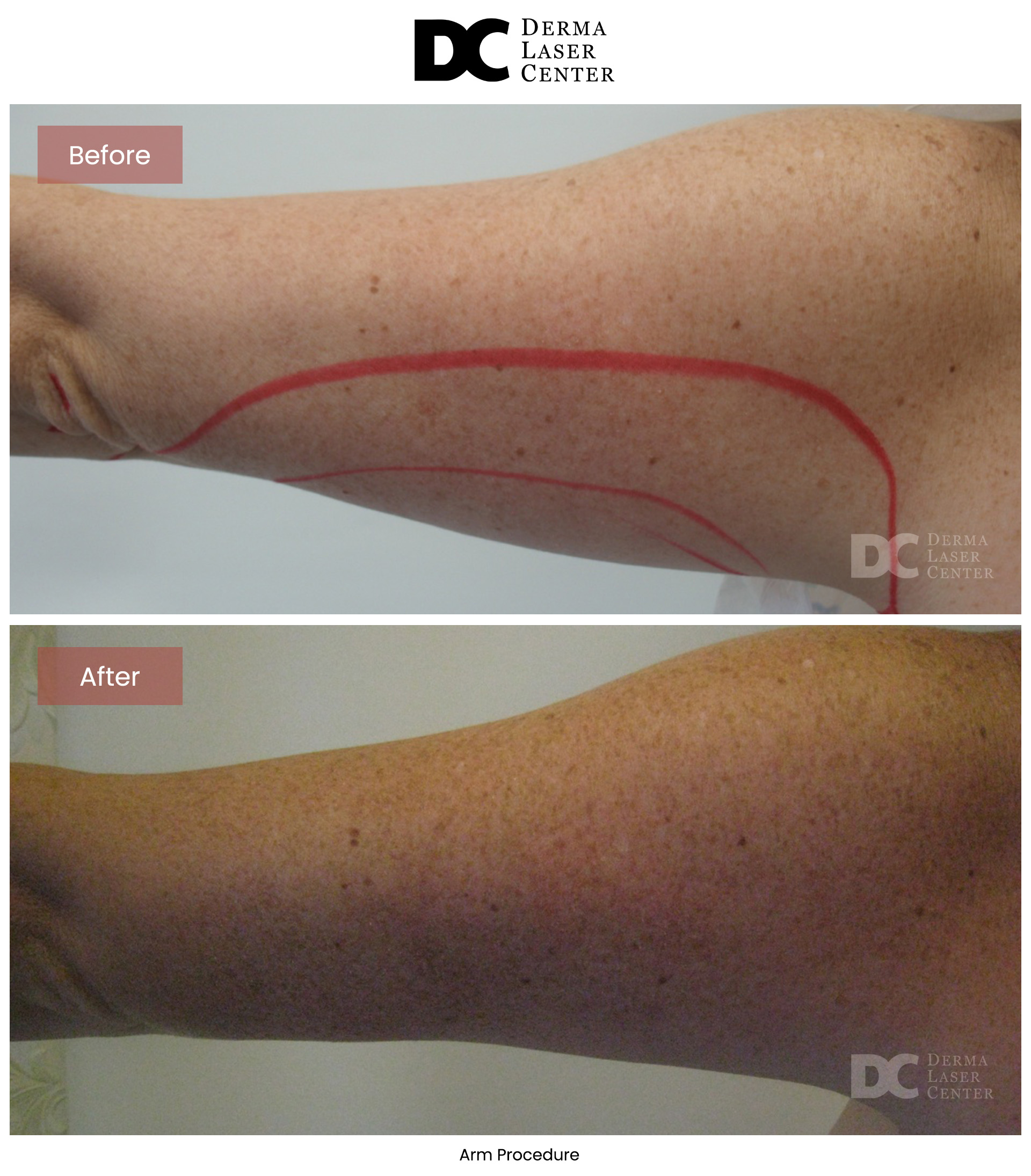 B&A Arms Image 46 V1