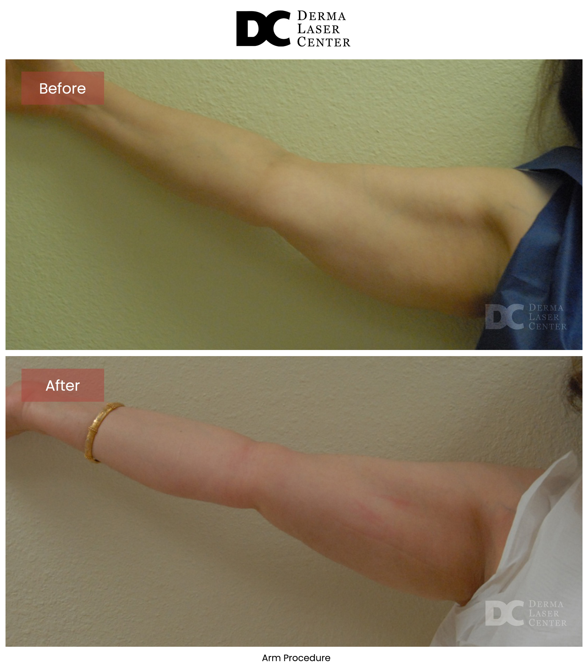 B&A Arms Image 48 V1