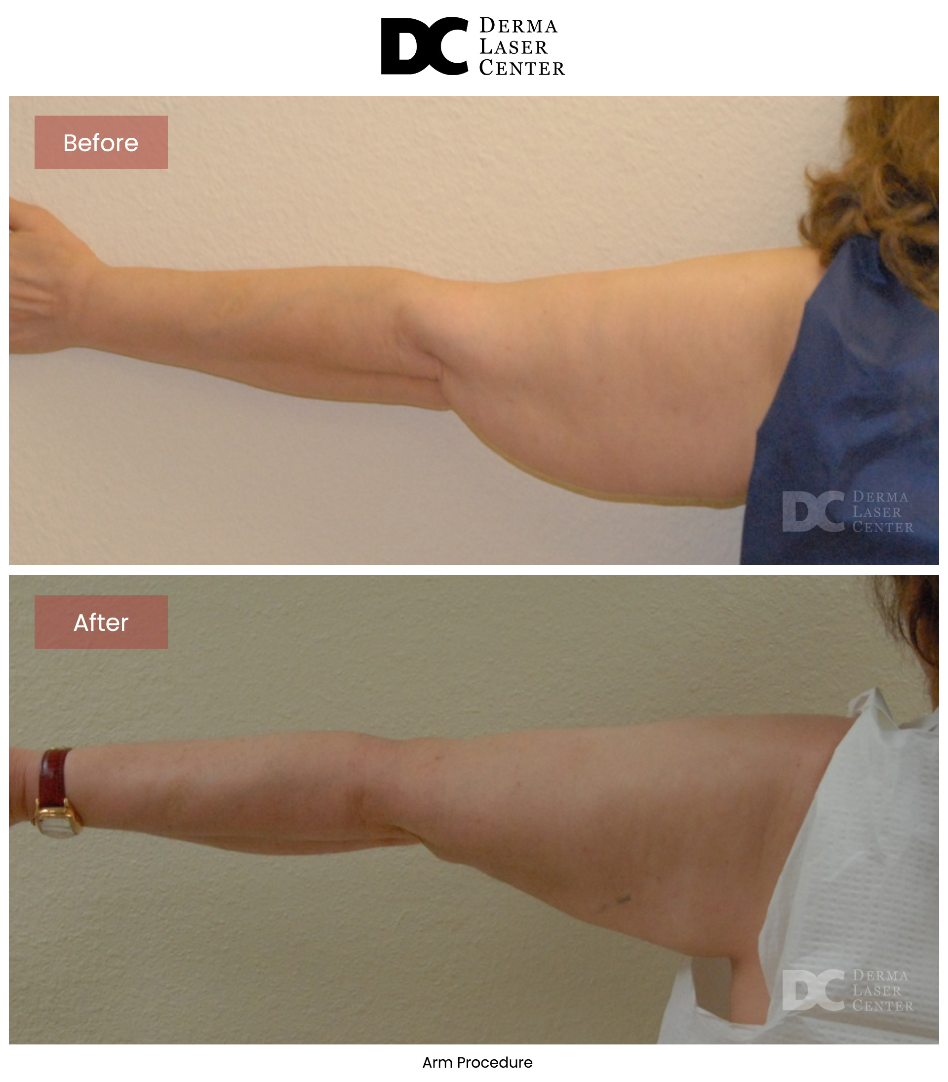 B&A Arms Image 50 V1