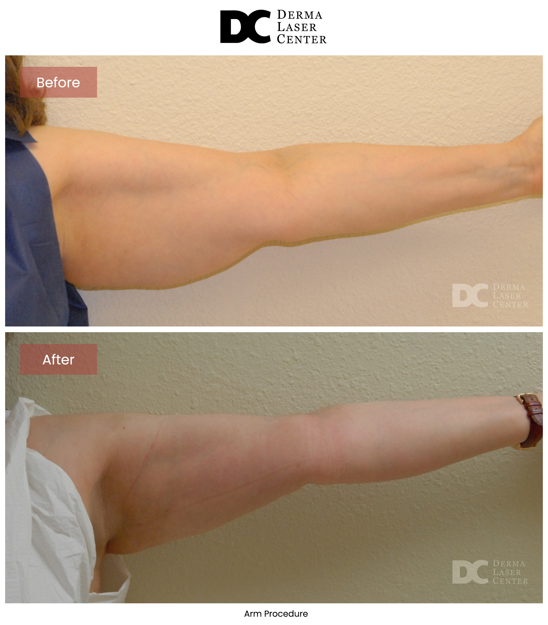 B&A Arms Image 51 V1